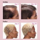 Hair Growth✝ Supplements for Women, 